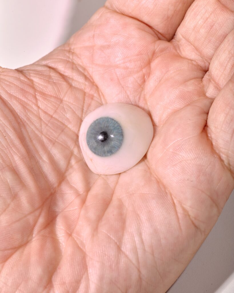 DStier_FTMag_FacialProthesis_1943